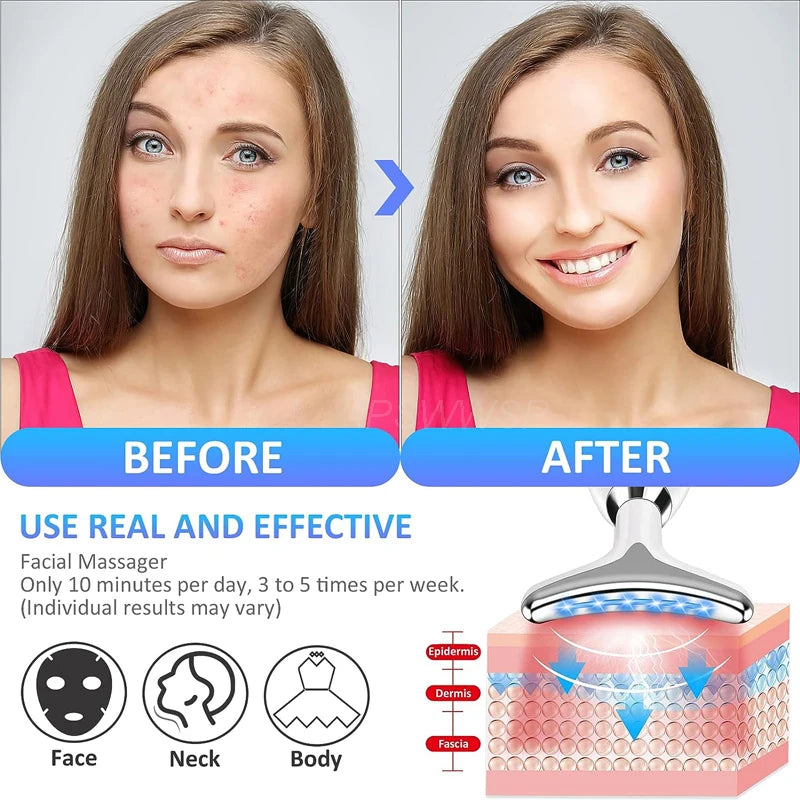 Massager Radiance Lift